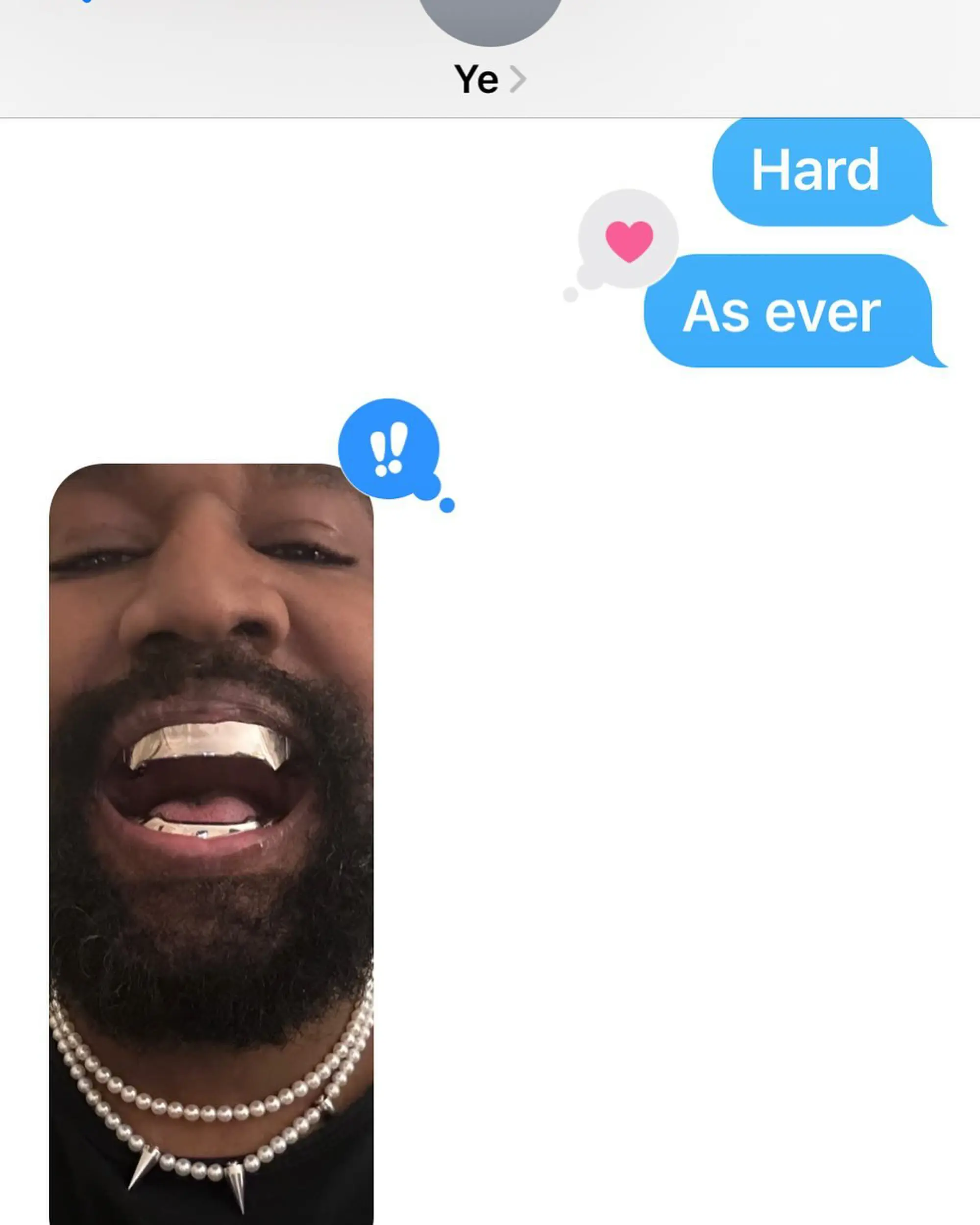 The Lowdown: Kanye LITERALLY Replaces Teeth With …Titanium?